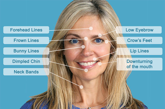 Botox treatment areas by dermatologist Dr. Levin in New Jersey