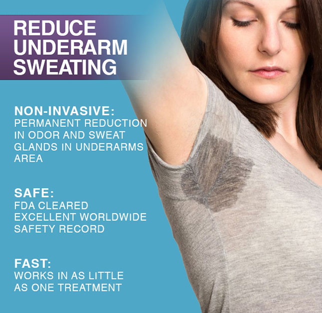 miraDry can treat excessive sweating