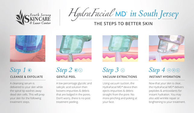 Several steps combine into one HydraFacial MD® treatment at South Jersey Laser Center.