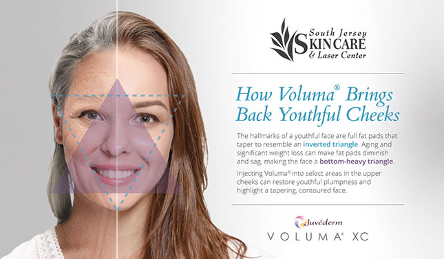 The tapering effect of Voluma® at South Jersey Skin Care & Laser Center can give the face a youthful inverted triangle shape.