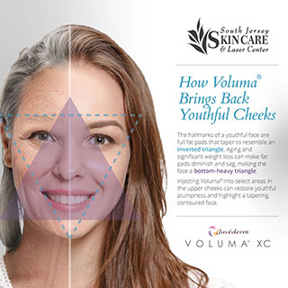The tapering effect of Voluma® at South Jersey Skin Care & Laser Center can give the face a youthful inverted triangle shape.
